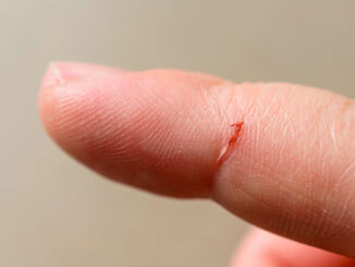 Kleine Schnittwunde am Finger